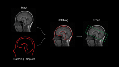 MRIワークフロー向上技術のイメージ